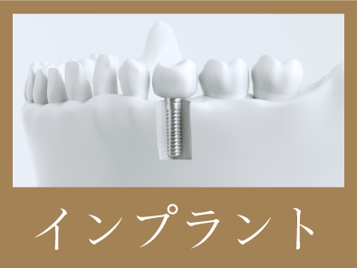 インプラント治療